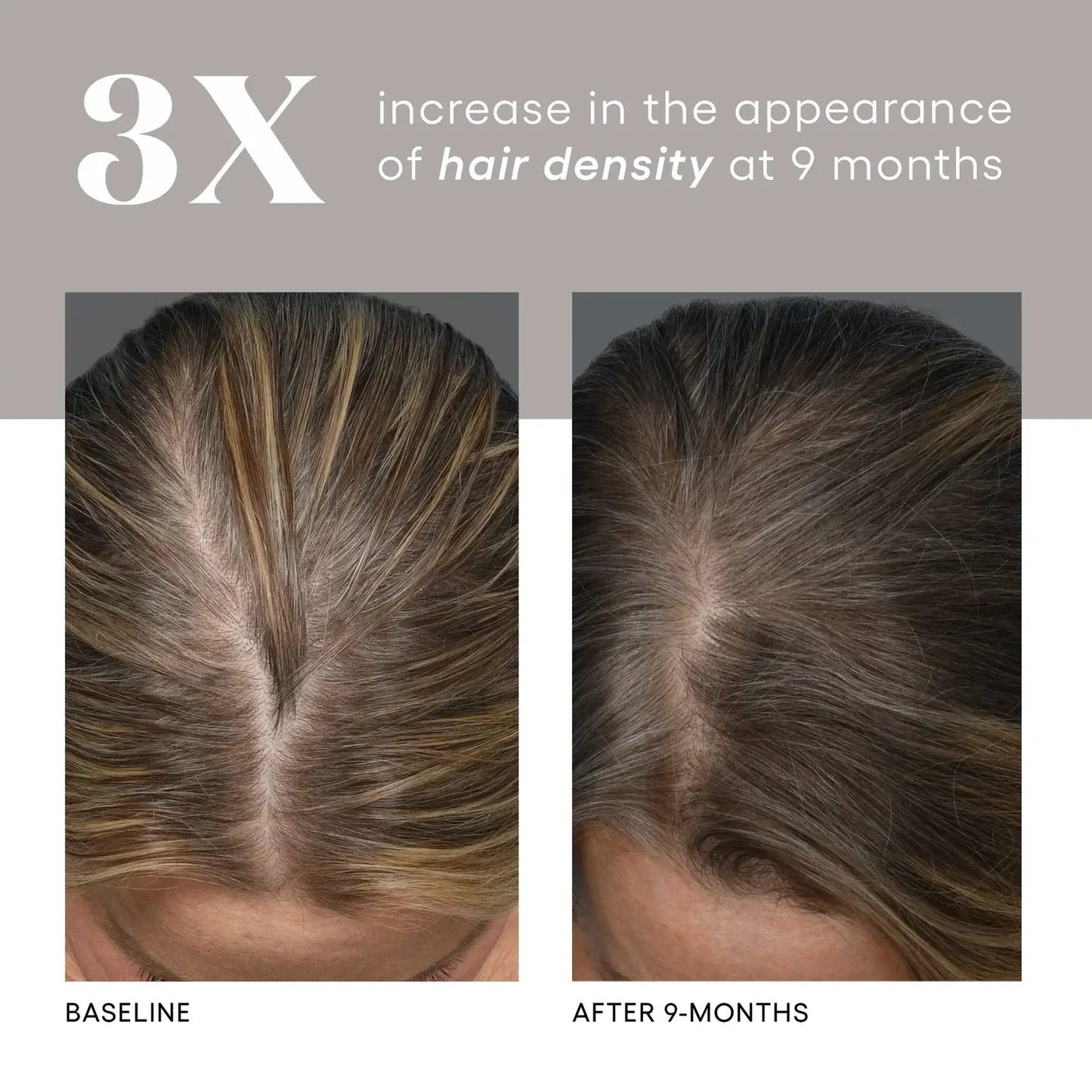 HAIR Serum  Targeted Renewal for the Scalp and Hair